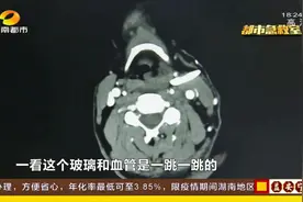 烟农遭玻璃扎颈，离总动脉仅1毫米！险刺破动脉失血不治！视频封面