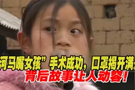 “河马嘴女孩”手术成功，口罩揭开满是惊叹，背后故事让人动容！视频封面