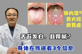 舌苔发白、且厚腻？可能是身体在传递3个坏消息！别不当回事视频封面