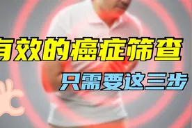 真正有效的癌症筛查：只需这三步！并没有想象的那么复杂，定期做视频封面