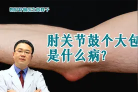 胳膊肘鼓个大包，好长时间消不下去！这是啥毛病？医生给您说清楚视频封面