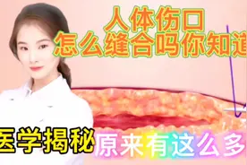 医学揭秘 原来人体的伤口是这样缝合的 看完你就明白了 手术缝纫视频封面