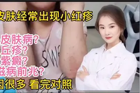 身体皮肤经常出现小红疹艾滋病前兆？丘疹？紫癜原因很多检查对照视频封面
