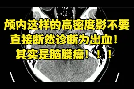 CT上团状高密度影不是出血？那是啥呢？几个小细节学会减少误诊！视频封面