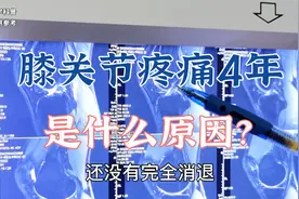 患者膝关节疼痛4年是什么原因？肖教授讲解适量运动的重要性视频封面
