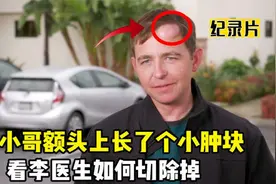 小哥额头上了小肿块，看看网红李医生如何切除掉，实在是太解压了视频封面