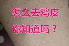 你不知道的去鸡皮方法，便宜又好用，你值得拥有