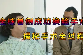 全球首例换脸手术成功，14名医生耗时23小时做了什么？视频封面
