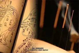 千年针迹   金石为开——人类非物质文化遗产代表作“中医针灸”视频封面