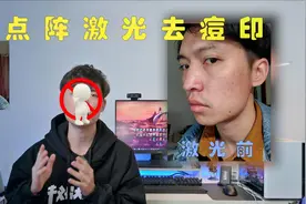 【祛痘vlog】10年痘印，点阵激光真的有效？视频封面