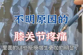 患者膝关节疼痛多年不知道是什么原因？肖教授阅片分析诊断病因视频封面