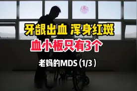 牙龈出血，浑身红斑，血小板只有3个！老妈的MDS (1/3）视频封面