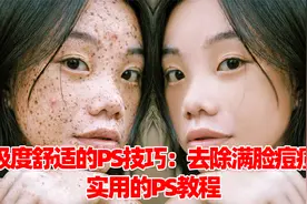 极度舒适的PS技巧：去除满脸痘痘，实用的PS教程！视频封面