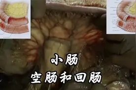 小肠：空肠和回肠视频封面