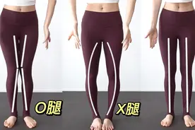 日本体态大师爆火矫正XO腿型｜轻松拥有细直美腿视频封面