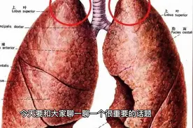 声音嘶哑不要大意，可能是肺癌在作祟!视频封面