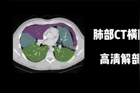 肺部CT横断面高清解剖图谱，附肺段分布、详细标注，建议收藏视频封面