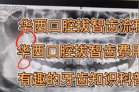 华西口腔就医流程、拔智齿费用、动物牙齿数量对比视频封面