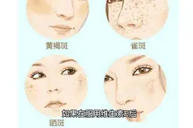 小孩脸上长雀斑能吃维E吗 #护肤小知识 #健康科普视频封面