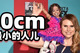 世界上最小的人，身高只有60cm，却早已是人生赢家！视频封面