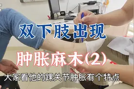 双下肢肿胀麻木而且怕冷是怎么回事？看肖教授如何探寻病因（2）视频封面