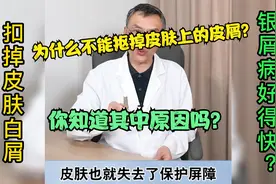 银屑病为什么不能抠掉皮肤上的皮屑，你知道其中原因吗？视频封面