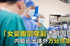 女婴腹部隆起透明圆球，内脏器官长出身体外，只有一层薄膜视频封面