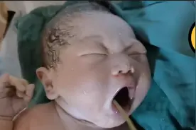听说你出生时吸了都是粑粑的羊水，是真的吗？视频封面