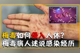 一个人感染梅毒后，身体会发生什么变化？梅毒病人述说感染经历视频封面