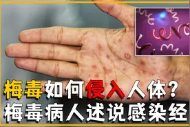 一个人感染梅毒后，身体会发生什么变化？梅毒病人述说感染经历视频封面
