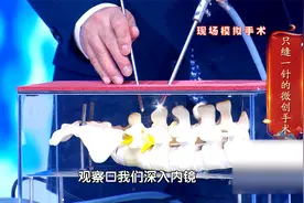 只缝一针的腰椎管狭窄微创手术，怎么做？5分钟就了解清楚！视频封面