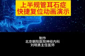 上半规管耳石症快捷复位动画演示视频封面