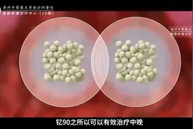 钇90微球治疗坐落广州中医药大学金沙洲医院视频封面