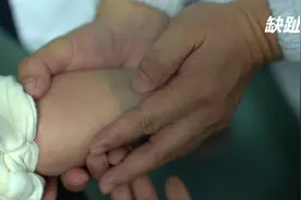 宝宝一根脚趾都没有，脚掌也发育不全，妈妈担心孩子以后走路视频封面