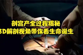 剖宫产全过程揭秘：3D解剖视角带你看生命诞生！视频封面