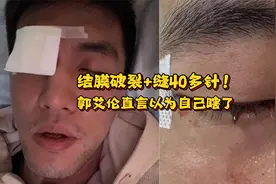 结膜破裂+缝40多针！郭艾伦自述受伤经过：训练中被队友直戳眼球视频封面