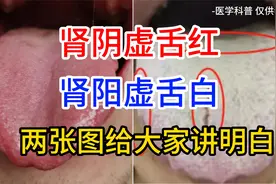 肾阴虚舌红，肾阳虚舌白，两张图讲明白