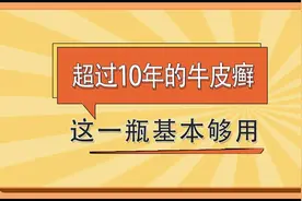 牛皮癣超过10年的，记住这一瓶，基本上够用视频封面