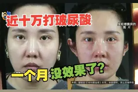 【1818黄金眼】九万八注射玻尿酸，一个月没效果了？视频封面