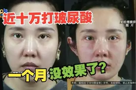 【1818黄金眼】九万八注射玻尿酸，一个月没效果了？视频封面