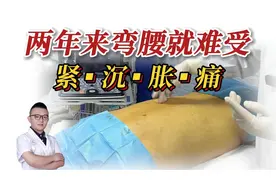 弯腰刷牙都难受！腰背筋膜炎胀痛松解后逐步变好、后悔没早来！视频封面