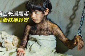 男孩身上长满黑毛，随后变成一只狼视频封面