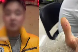 店家曝顾客手指被筷子扎破治疗花一万七 医院：未接到有关方异议视频封面