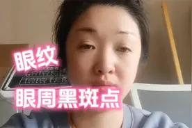 眼周长了黑斑点别担心，这套护理方法经常做，轻松代谢黑斑和眼纹视频封面