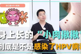 身上长了“小肉揪揪”，到底是不是感染了HPV病毒？医生为你解答视频封面