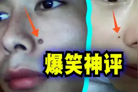 爆笑解说：痣长在鼻子旁边有什么意义吗？