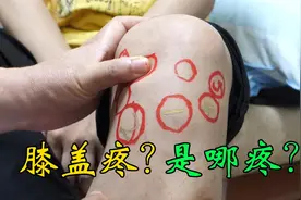 膝关节不同地方的疼痛，说明不同疾病，骨科医生帮您辨别视频封面