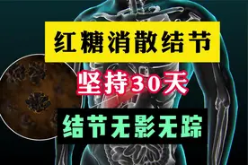 红糖消散结节，坚持30天，对结节有帮助！视频封面