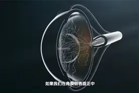 20眼球的发育到几岁才算成熟？视频封面