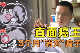 70岁医生胰腺癌晚期挺过2年，肿瘤几乎没了！是什么给她带来救赎视频封面